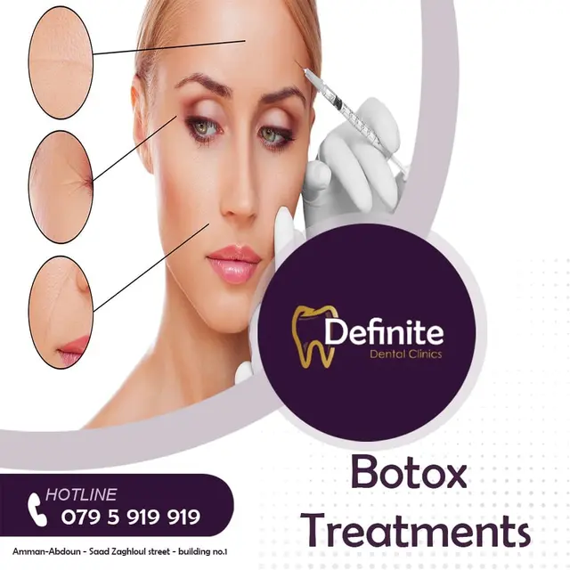 Botox for Face
