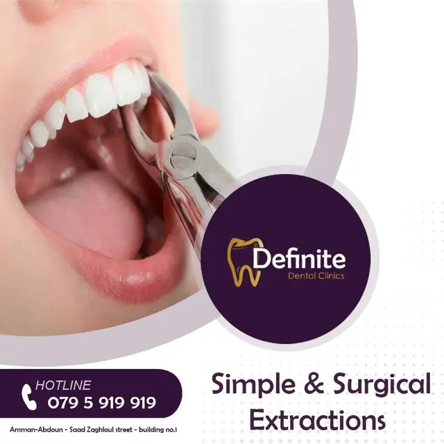 Simple and Surgical Extractions