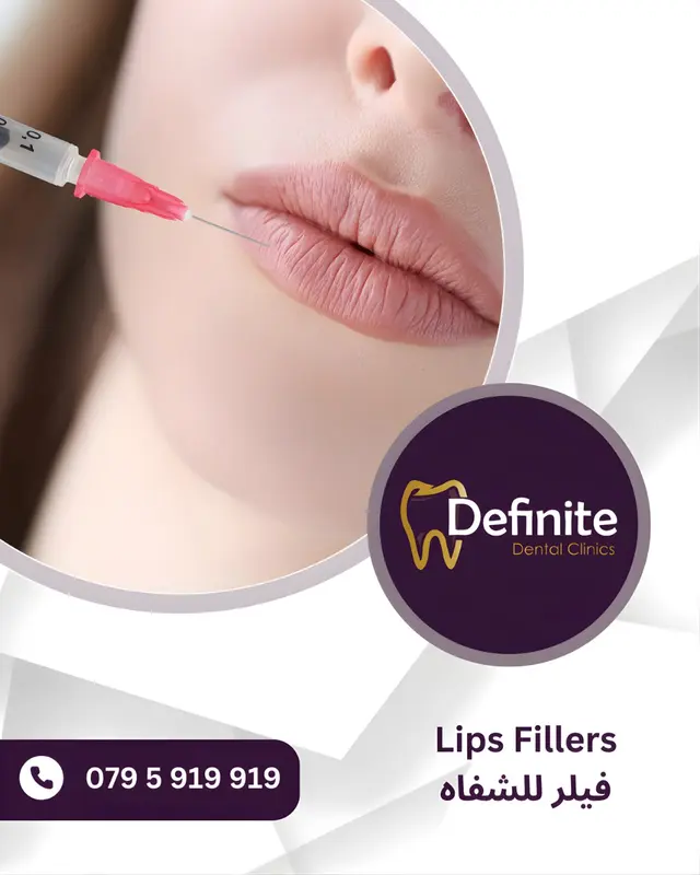 Lip Fillers