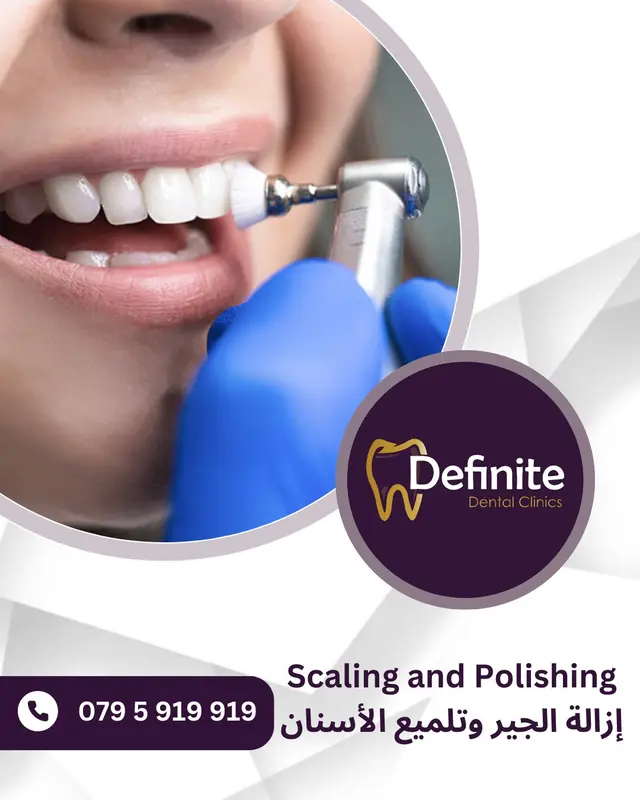 Scaling and Polishing