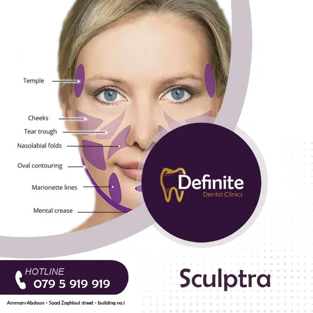 Sculptra